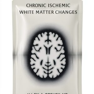 Multiple Sclerosis Guide Kindle Edition by HealthPress 74‑Page eBook-0